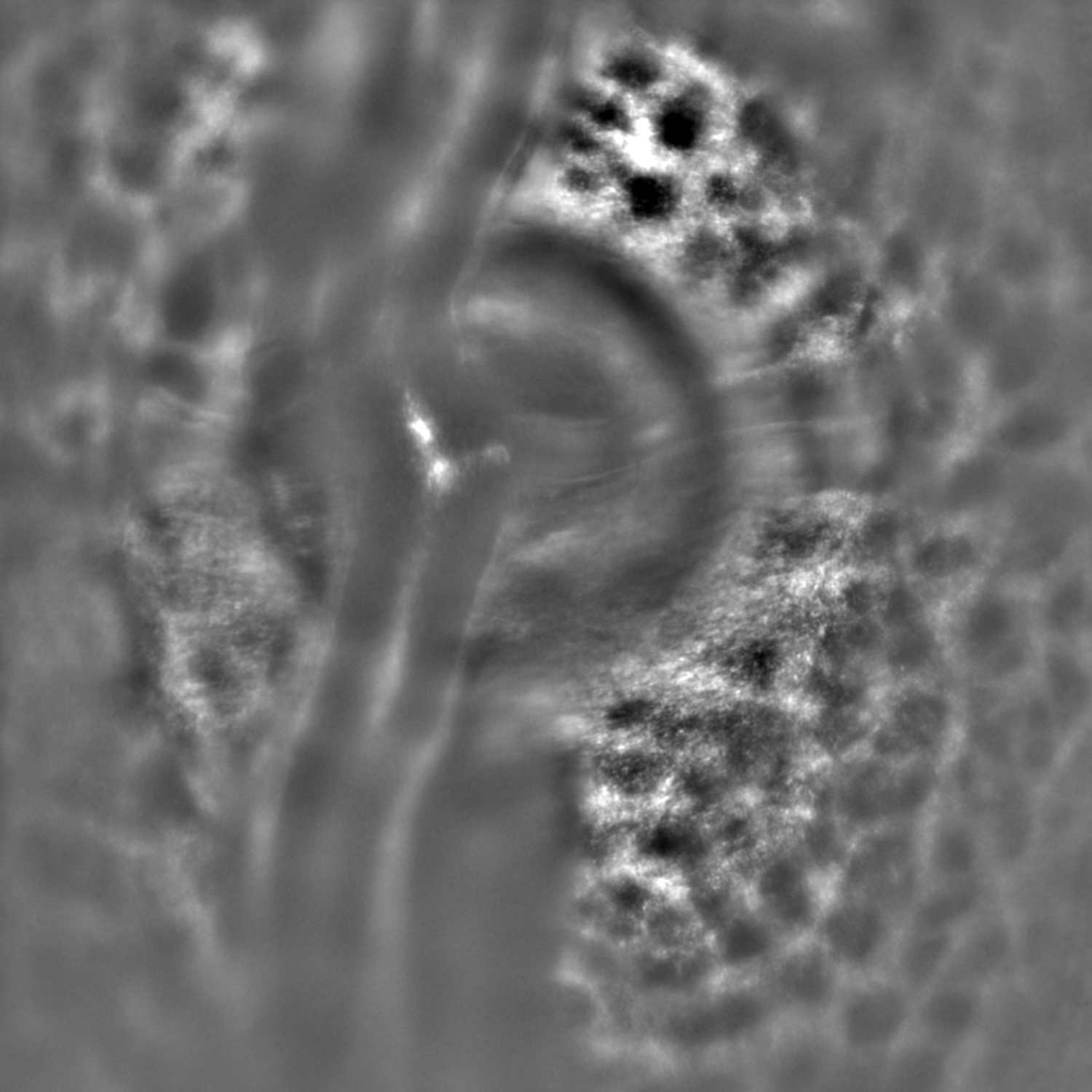 Lamina cribrosa in a healthy cynomolgus monkey.