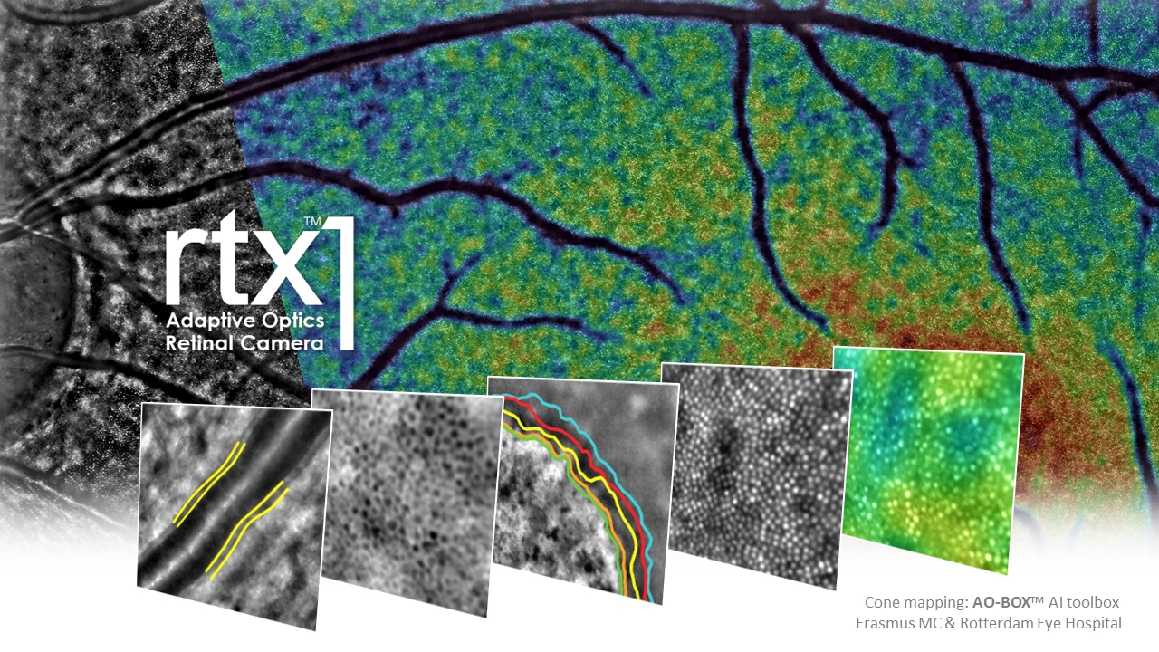 2026 - rtx1 images biomarkers - over white - 16x9 1280