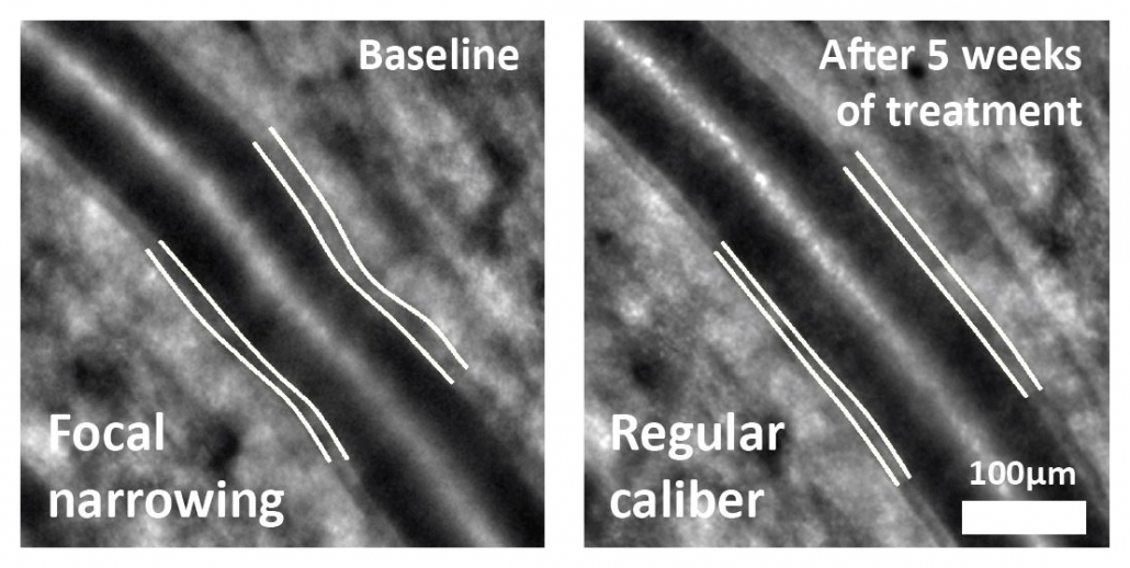 rtx1 Adaptive optics retinal camera • Imagine Eyes