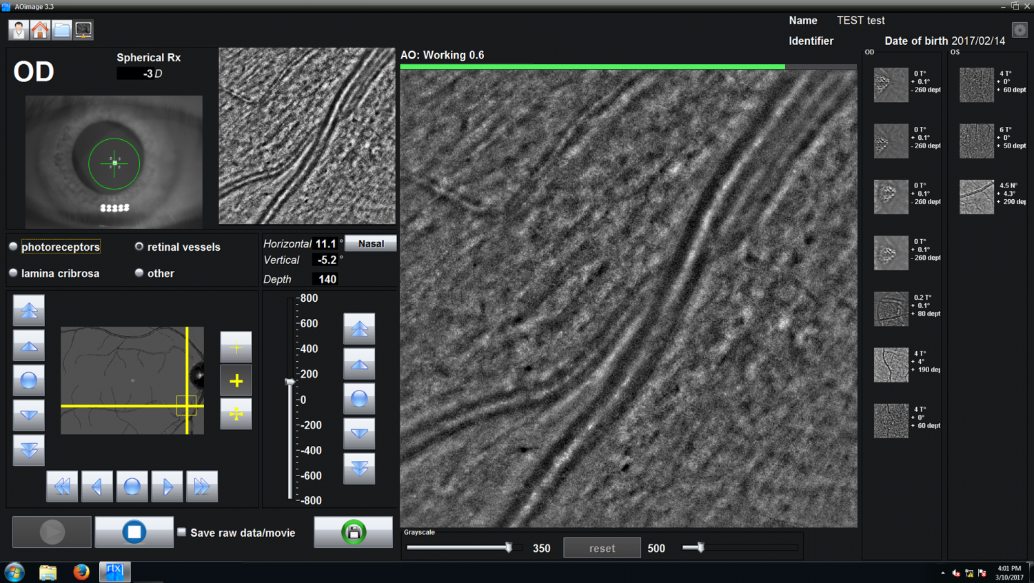 rtx1 Adaptive optics retinal camera • Imagine Eyes