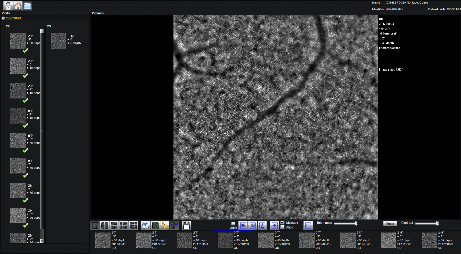 rtx1 Adaptive optics retinal camera • Imagine Eyes