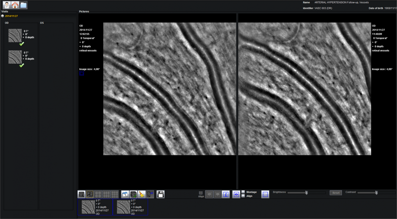 rtx1 Adaptive optics retinal camera • Imagine Eyes