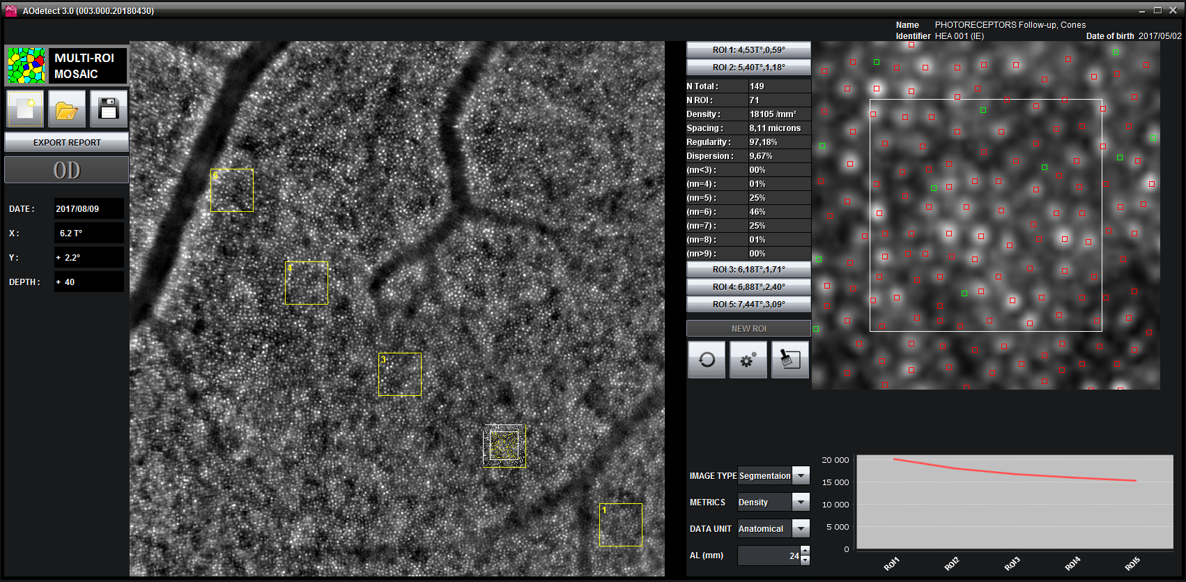 AOdetect Mosaic - Multi-ROI mode