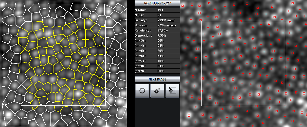 AOdetect Mosaic - Segmentation of parafoveal cone cells