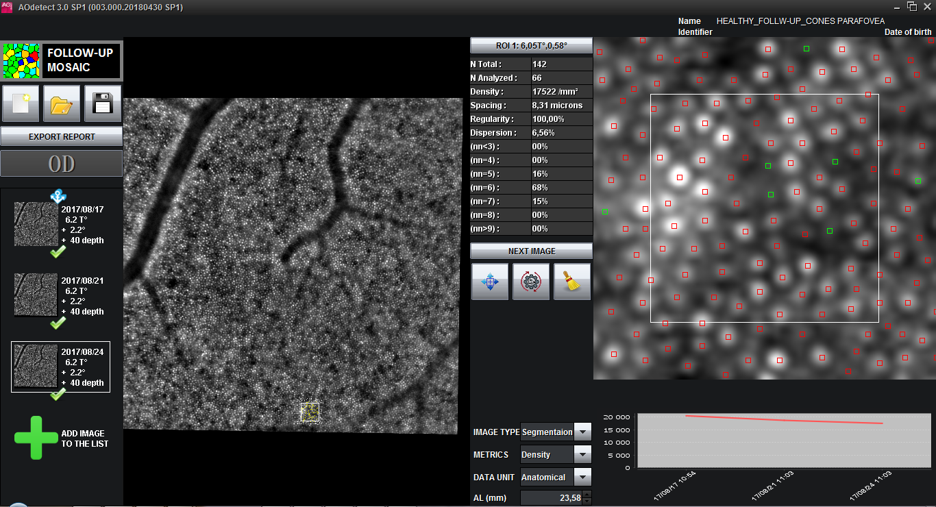 AOdetect Mosaic - Follow-up mode