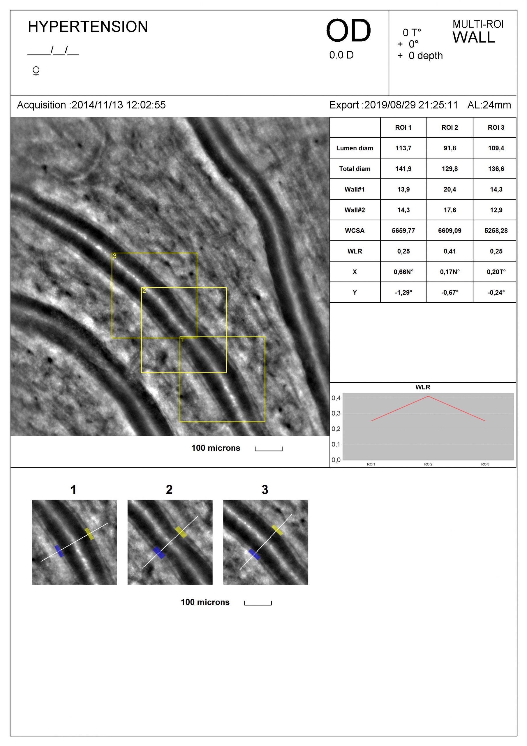 AOdetect Wall - Multi-ROI mode - Report