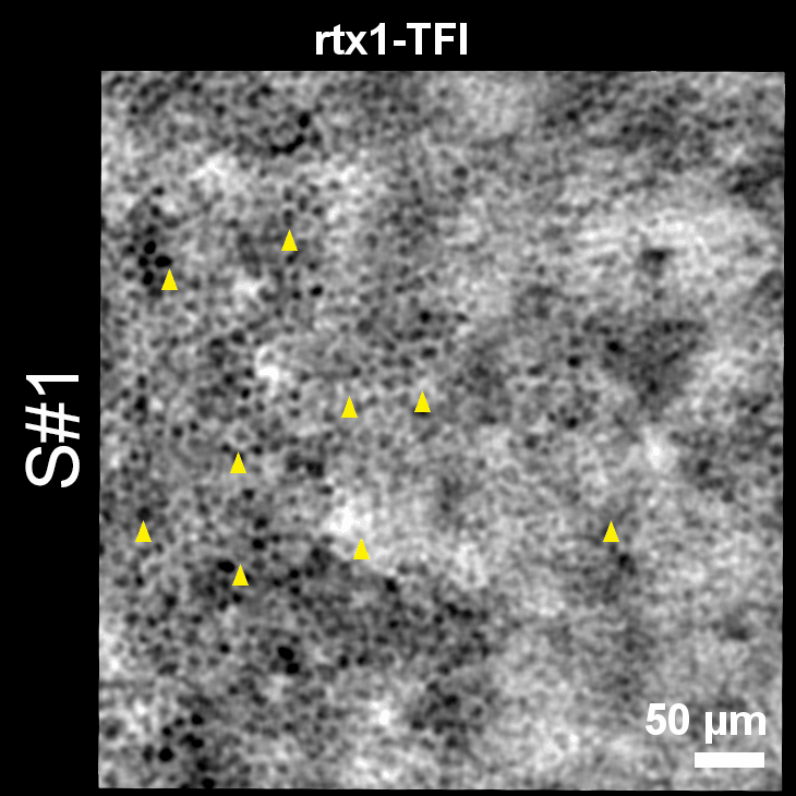 RPE cells on rtx1-TFI and NIRAF images