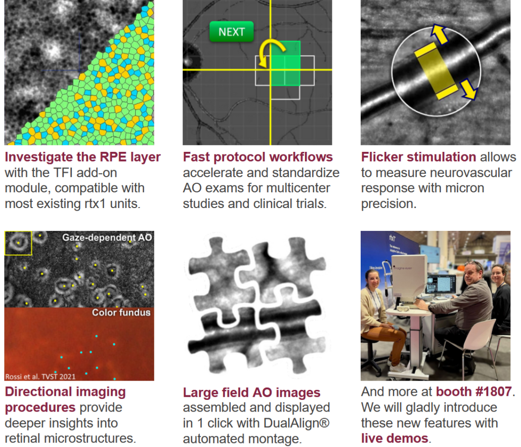 ARVO 2024 • Imagine Eyes